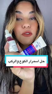 حل اسمرار الكوع والركب