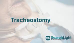 Image result for Tracheostomy