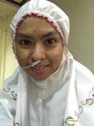Melihat reaksiku andre pun semakin ganas, setelah puas melumat bibirku giliran leherku, telingaku, dan pundakku yang digarapnya. Waktu Pembedahan Satu Saraf Telah Bengkok Melekat Di Tiroid Wanita Ini Kongsi Derita Kanser Tahap 2 Selepas Pembedahan Tiroid Keluarga