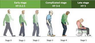 We did not find results for: The Five Stages Of Parkinson S Diesease Parkinson S Nsw