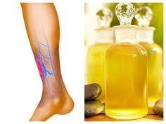 Ei bine, problemele de circulatie ating din pacate mai ales oamenii tineri. Pin On Naturiste