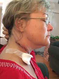 Fundraiser for Laurie Campbell by Janet Coster : Help Laurie Fight Cancer  and Win !