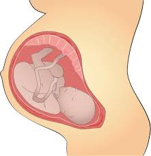 Is it possible to be born without a belly button? Understanding The Umbilical Cord Cells For Life