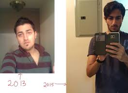Osing weight is no picnic. Pics 1 5 Year Skinny Fat Face Transformation On Keto Keto