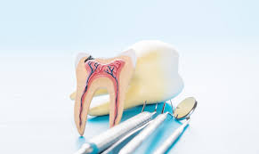 A root canal is considered a restorative procedure. Root Canal Treatment Procedure In 5 Steps