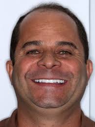 🔹 Finalizamos mais um caso de reabilitação oral extensa, sobre dentes  naturais e implantes dentários para devolver ao nosso paciente função  mastigatória, estética do sorriso e sobretudo autoestima. Foram planejadas  e executadas