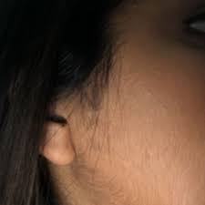 Hair removal creams are another popular option for removing peach fuzz. Help With Facial Hair Peach Fuzz On Face Facial Hair Facial
