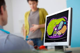 È quello che in termini scientifici viene definito come epatomegalia. Dieta Per Fegato Ingrossato Metodi Per Dimagrire