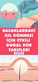 Bacaklardaki Kil Donmesi Icin Etkili Dogal Kur Tarifleri Www Vipbakim Com Bacaklar Dogal Dogal Cilt Bakimi