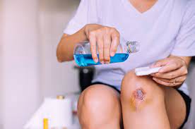 How To Tell If My Wound Is Infected - Elitecare Emergency Hospital
