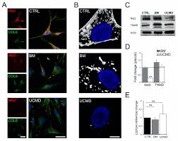 Jun 10, 2013 · life sciences/grade 10 ncs13question 33.1 study the diagram below and answer the questions that follow:3.1.1 explain the difference between a food chain and a food web. Cells Free Full Text Tendon Extracellular Matrix Remodeling And Defective Cell Polarization In The Presence Of Collagen Vi Mutations Html