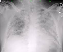 Image result for Pseudoeriosema