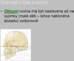 Mediánní (střední) rovina = rovina zrcadlové souměrnosti. Radiologicko Anatomicke Anatomicke Korelace Pdf Free Download