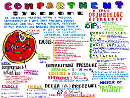 Image result for Compartment Syndrome