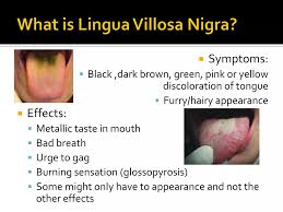 Image result for black tongue symptoms