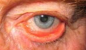 Image result for Blepharis gazensis