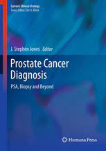 The pancreas is a bodily organ that few people think about. Prostate Cancer Diagnosis Psa Biopsy And Beyond J Stephen Jones Springer