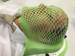 This resource does not discuss benign tumors of the head and neck region, tumors of the thyroid, skin cancers involving the head and neck, auditory. Radiation Cisplatin Established As Standard Of Care For Hpv Related Head And Neck Cancer Imaging Technology News