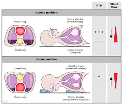 We did not find results for: Physiology Prone Positioning Uptodate