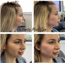 TOP 10 BEST Botox near Los Alamitos, CA 90720