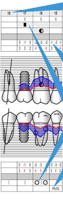 periodontal chart department of periodontology school of