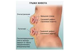 Gryzha Beloj Linii Zhivota Lechenie V Moskve V Universitetskoj Klinike Mgu Im M V Lomonosova