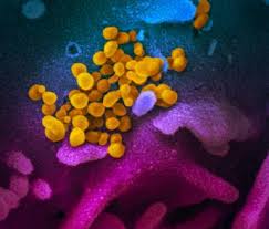 New Images Of Novel Coronavirus Sars Cov 2 Now Available Nih National Institute Of Allergy And Infectious Diseases