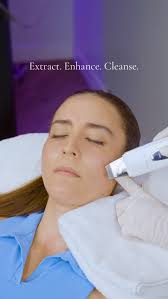 The Nurse Jamie Sleep Tape infused with Hyaluronic Acid is finally here —  now available for pre-order! 💤