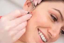 ENHANCE ELECTROLYSIS