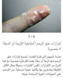 الافرازات البيضاء قبل الدورة التغيرات التي تحدث قبل الدوره اجمل الصور