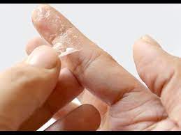 Why does super glue stick to your fingers? Easy Way To Get Rid Of Super Glue Remove Super Glue Youtube