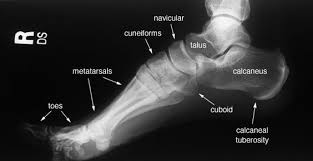 Mri of the ankle and feet. Radiographic Anatomy Of The Skeleton Foot Lateral View Labelled Radiology Student Medical Knowledge Radiology