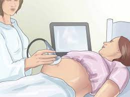 Varices Vulvares Durante El Embarazo Youtube