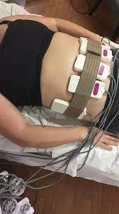 Fi8ure 8 Body Contouring Sculpting 2810 Louetta Rd Suite 1 Spring Tx 77388 Usa
