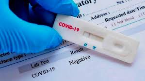 Pcr test kosten die entnahme des abstriches findet in einem unserer corona test zentren statt, bei größeren testmengen ist die entnahme des corona abstrichs auch bei ihnen vor ort möglich. Pcr Test Fur Sars Cov 2