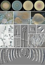 Image result for Kyphocarpa