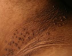 Image result for Thesium nigricans