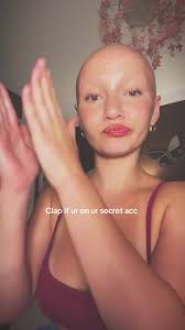 Caroline Manning Alex Schlab