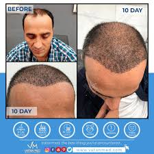10 Days Later
