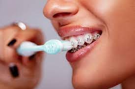 Start by removing loose food particles. How To Brush Teeth With Braces Greater Hartford Orthodontics
