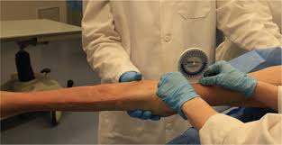 Image result for Ober Test