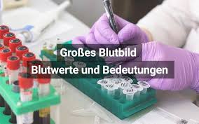 Grosses Blutbild Alle Werte Und Bedeutungen Praktischarzt