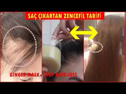 Kesinlikle Ise Yariyor Zencefili Sur Sac Dokulmesini Durdur Sac Cikartan Dogal Tarif Saccikartan Youtube 2020 Sac Hizli Sac Uzama Sac Dokulmesi