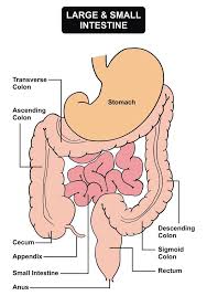 The sigmoid colon is the area of the intestine just above the rectum; Colon Resection Treating The Large Intestine Colorectal Surgeons Long Island Ny