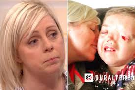 Mum takes to GMB to slam Instagram for 'condoning' people's attitudes  towards her disabled son's appearance... after they removed photo of him
