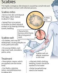 Image result for human scabies
