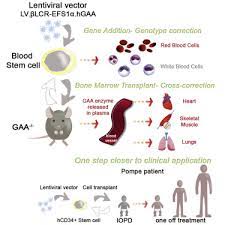 Maybe you would like to learn more about one of these? Lentiviral Hematopoietic Stem Cell Gene Therapy Rescues Clinical Phenotypes In A Murine Model Of Pompe Disease Sciencedirect
