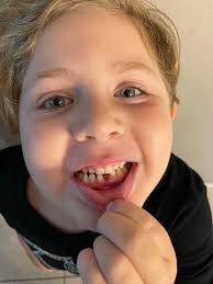 Child's First Lost Tooth Experience