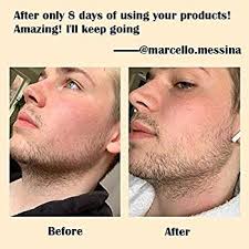 As long as you aren't taking male hormones, or any other medication which affects hormone product. Amazon Com Beard Growth Kit Derma Roller With Biotin Beard Growth Oil Serum Derma Roller Natural Beard Oil For Men Patchy Beard Growth With Beard Roller Cleanser And Comb Beauty