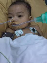 Prayers for girl with rare moyamoya condition